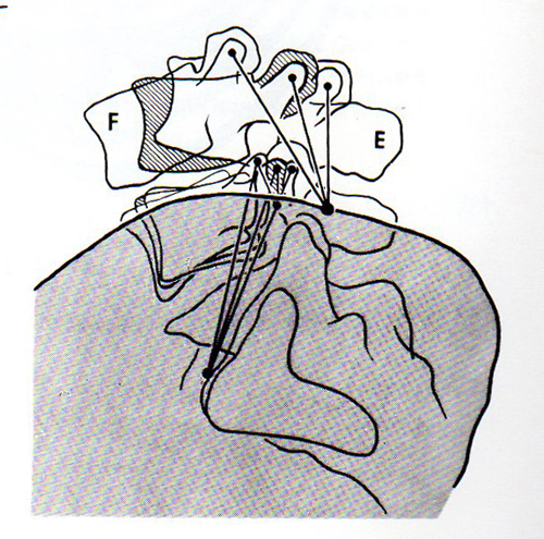 腸腰靭帯の図