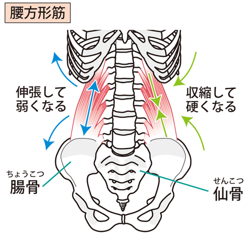 腰方形筋の図