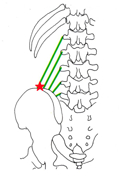 腰方形筋模式図