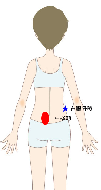 問診で痛む箇所の図